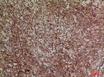 SNAP 23 antibody