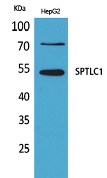 SPTLC1 rabbit pAb