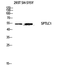 SPTLC1 rabbit pAb