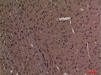 SPTLC1 antibody