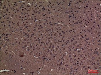 SPTLC1 rabbit pAb