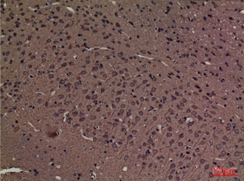 SPTLC1 antibody