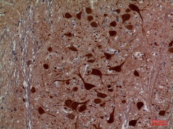 HEXA antibody