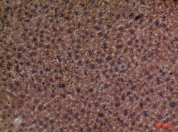 PEPCK-C antibody