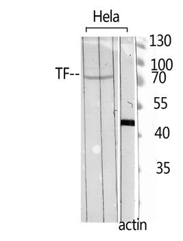 Transferrin antibody