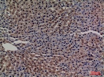 Transferrin rabbit pAb Antibody