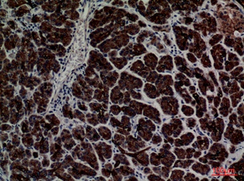 CD1E rabbit pAb
