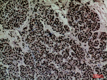 CD2 rabbit pAb