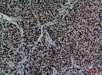 CD2 antibody