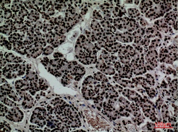 CD2 antibody