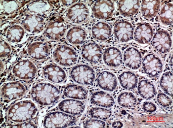 CD59 rabbit pAb