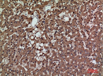 PSG1 antibody