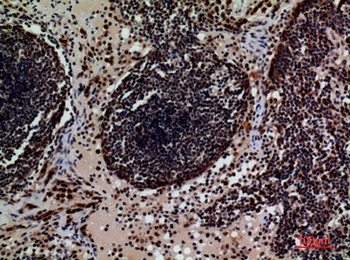 CD79b rabbit pAb