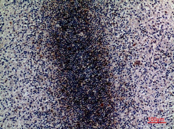 CD79b rabbit pAb