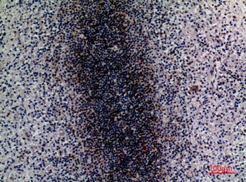 CD79b antibody