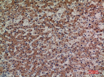 CD85g antibody