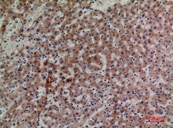 CD85g antibody