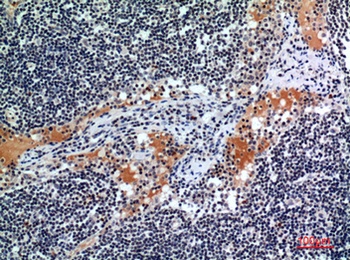 CD116 rabbit pAb