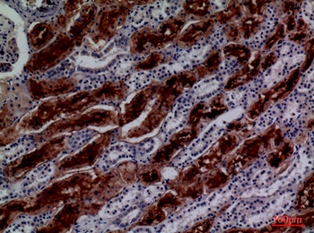 GGT1 antibody