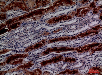 GGT1 antibody