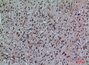 CD307 rabbit pAb Antibody