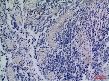 CXCR-3 antibody