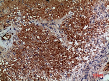 CD241 antibody