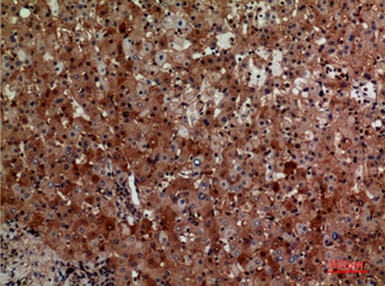 CD276 antibody