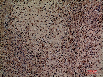 CD201 antibody