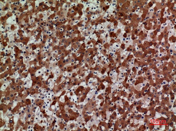 CKR-3 antibody