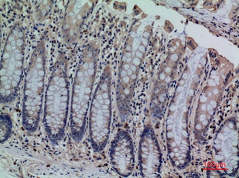 CDCP1 antibody