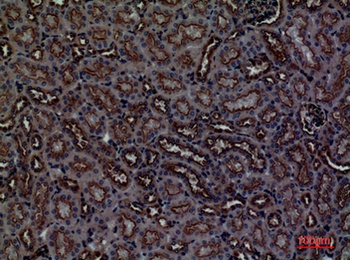 CDCP1 rabbit pAb