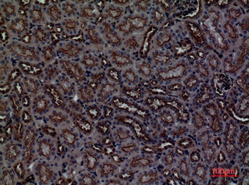 CDCP1 antibody