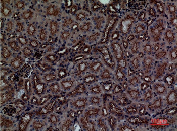 CDCP1 antibody