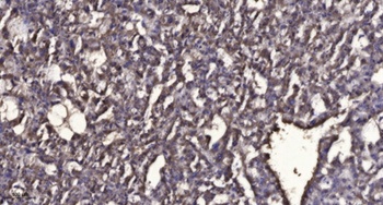 PSP antibody