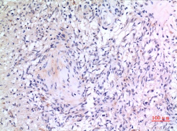 VGF antibody