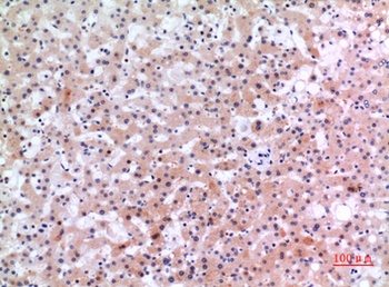 Inhibin beta-E antibody