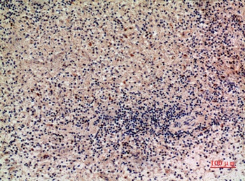 Lymphotactin antibody