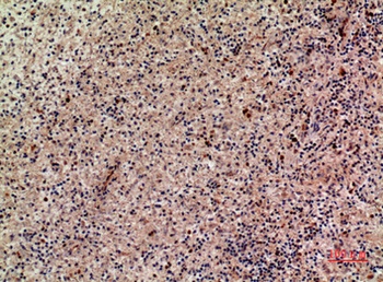 Lymphotactin rabbit pAb