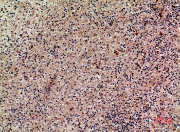 Lymphotactin antibody