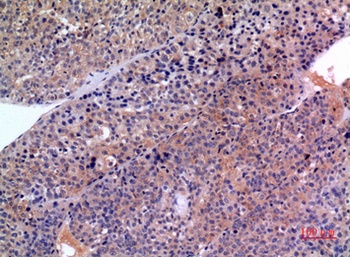 SCCA1/2 antibody