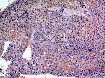 SCCA1/2 antibody