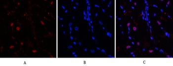 Bcl-6 antibody