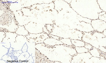 Bcl-6 rabbit pAb