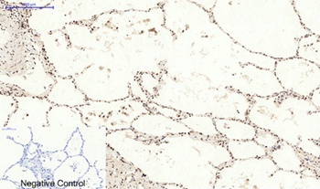 Bcl-6 antibody