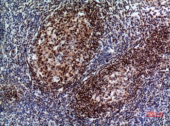 Pax-5 antibody