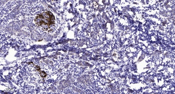 RFC1 antibody