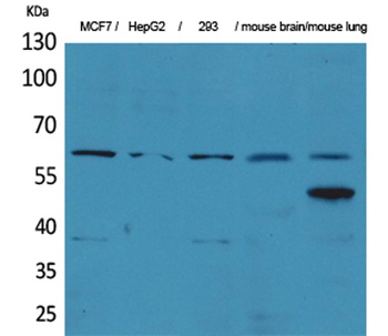 ZKSCAN4 rabbit pAb Antibody