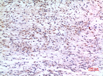 ZKSCAN4 rabbit pAb Antibody