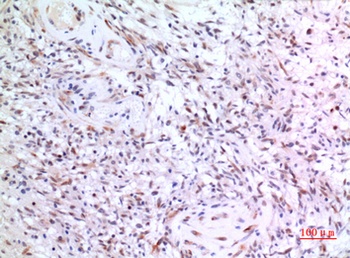ZKSCAN4 rabbit pAb Antibody